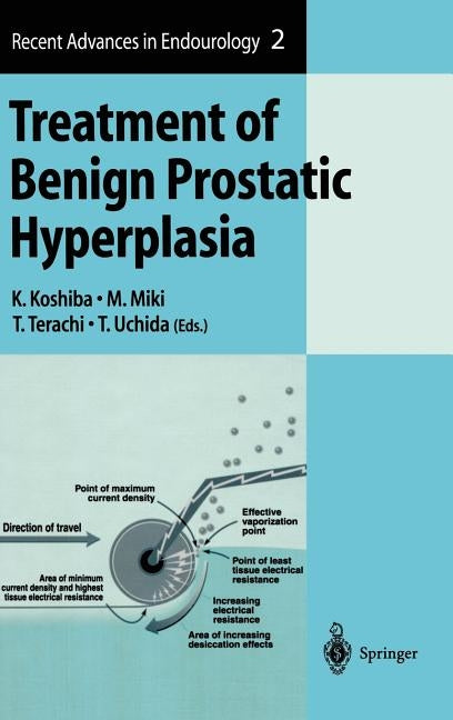 Treatment of Benign Prostatic Hyperplasia by Koshiba, K.